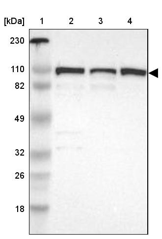 Lane 1: Marker [kDa] 230, 110, 82, 49, 32, 26, 18<br/>Lane 2: Human cell line RT-4<br/>Lane 3: Human cell line U-251MG sp<br/>Lane 4: Human cell line A-431