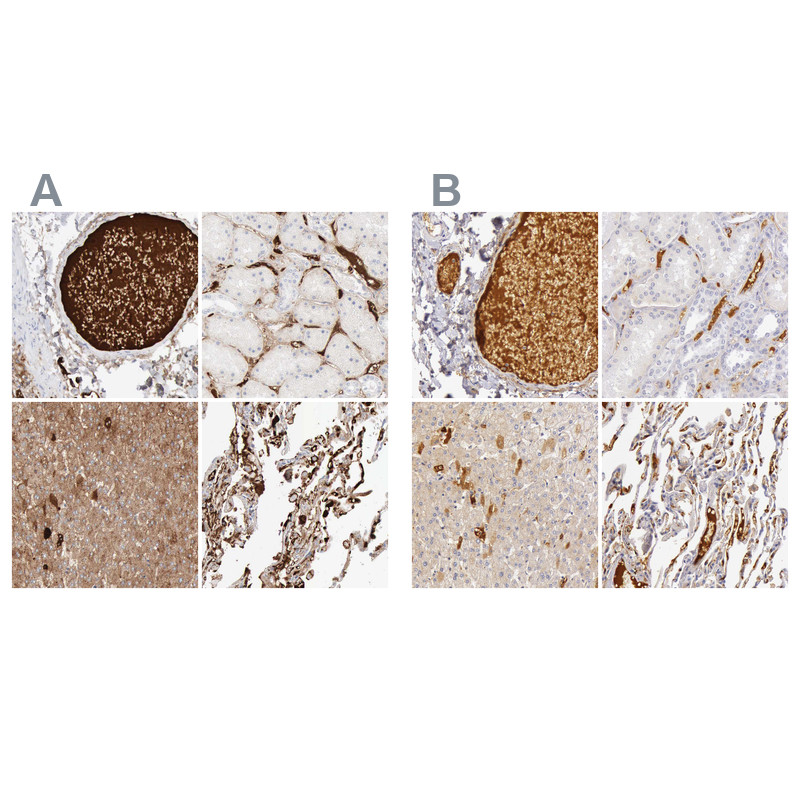 Immunohistochemical staining of human colon, kidney, liver and lung using Anti-C4BPA antibody HPA000926 (A) shows similar protein distribution across tissues to independent antibody HPA001578 (B).