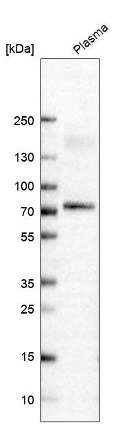 Western blot analysis in human plasma.