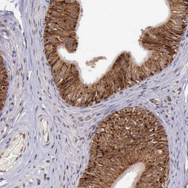 Immunohistochemical staining of human epididymis shows strong cytoplasmic positivity in glandular cells.