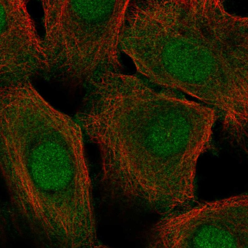 Immunofluorescent staining of human cell line hTCEpi shows localization to nucleus & cytosol.