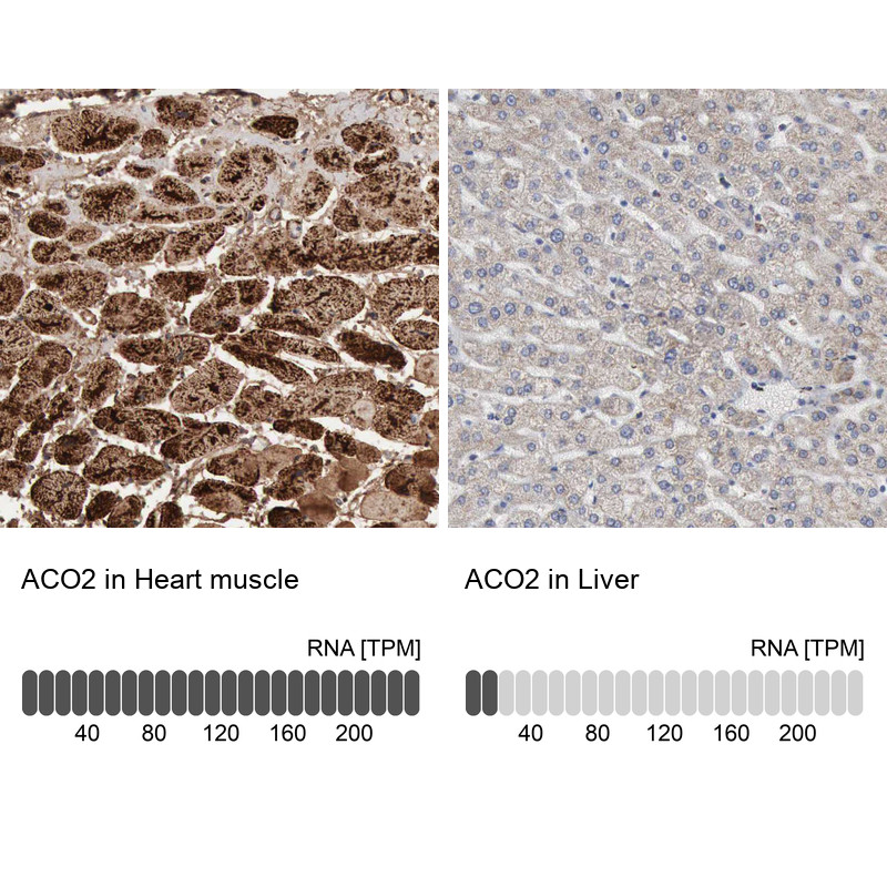 Immunohistochemistry analysis in human heart muscle and liver tissues using HPA001097 antibody. Corresponding ACO2 RNA-seq data are presented for the same tissues.