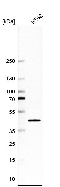 Western blot analysis in human cell line K562.