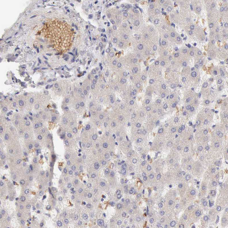 Immunohistochemical staining of human liver shows moderate positivity in erythrocytes.