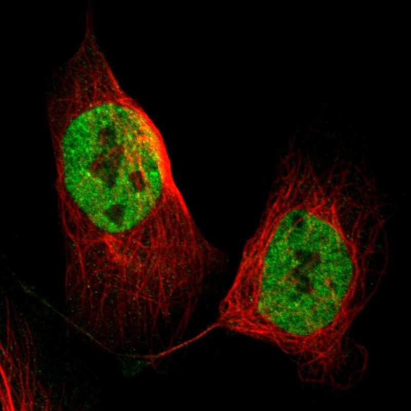 Immunofluorescent staining of human cell line U-2 OS shows localization to nucleoplasm.