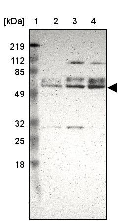 Lane 1: Marker [kDa] 219, 112, 85, 49, 32, 25, 18<br/>Lane 2: Human cell line RT-4<br/>Lane 3: Human cell line U-251MG sp<br/>Lane 4: Human cell line A-431