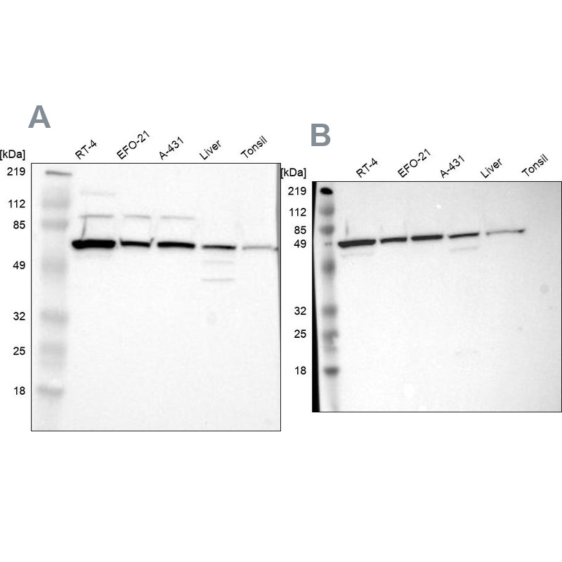 Western blot analysis using Anti-CKAP4 antibody HPA001225 (A) shows similar pattern to independent antibody HPA000278 (B).