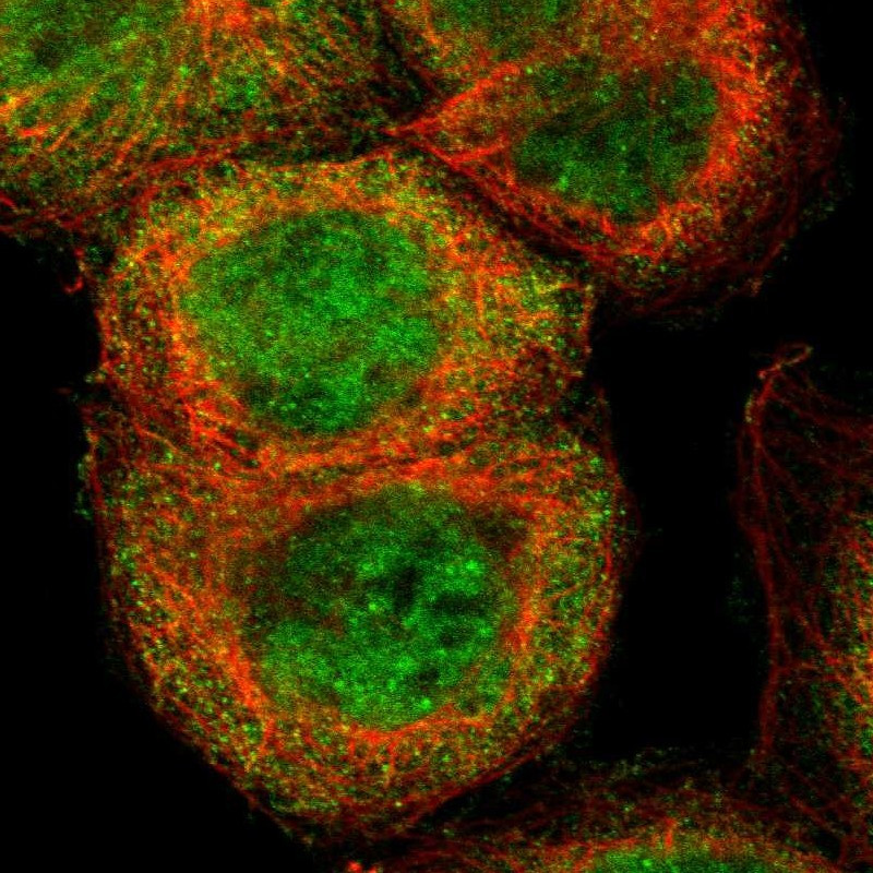 Immunofluorescent staining of human cell line A-431 shows localization to nucleoplasm & cytosol.