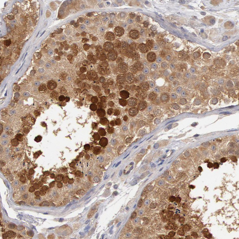 Immunohistochemical staining of human testis shows moderate to strong cytoplasmic and nuclear positivity in cells in seminiferous ducts.