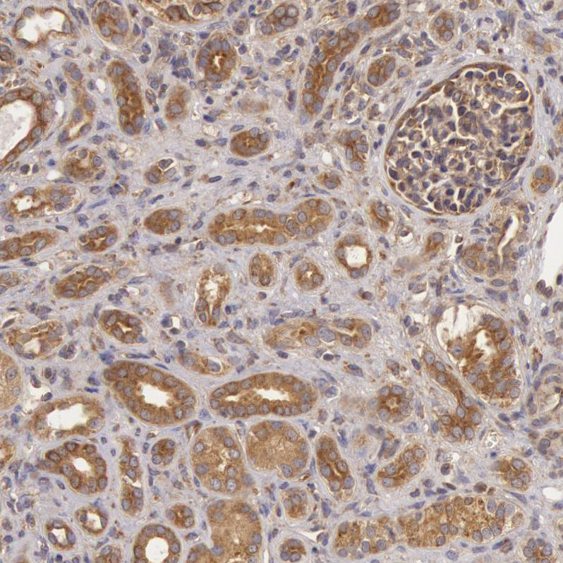 Immunohistochemical staining of human kidney shows moderate cytoplasmic positivity in cells in tubules.