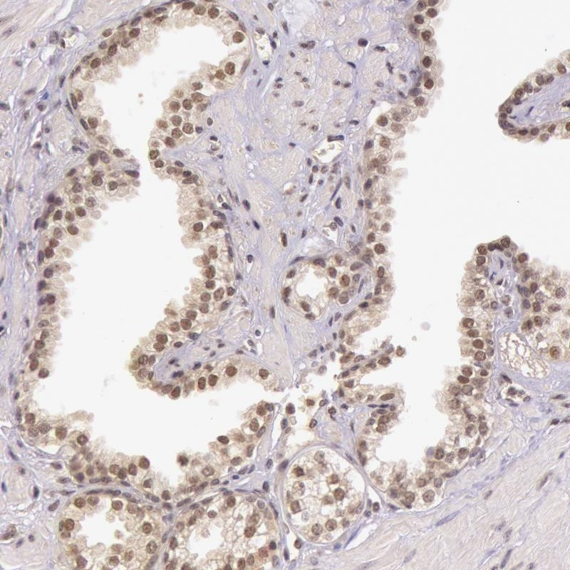 Immunohistochemical staining of human prostate shows nuclear positivity in glandular cells.