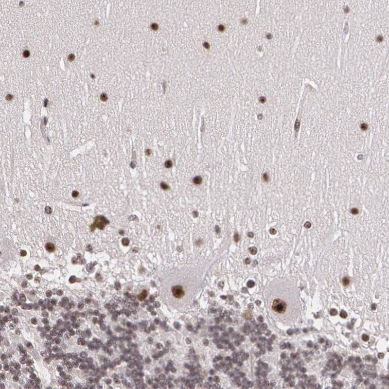 Immunohistochemical staining of human cerebellum shows strong nuclear positivity in purkinje cells and cells of molecular layer.