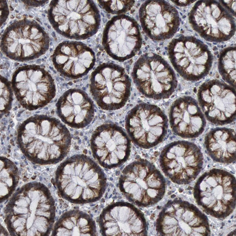 Immunohistochemical staining of human rectum shows cytoplasmic positivity in glandular cells.