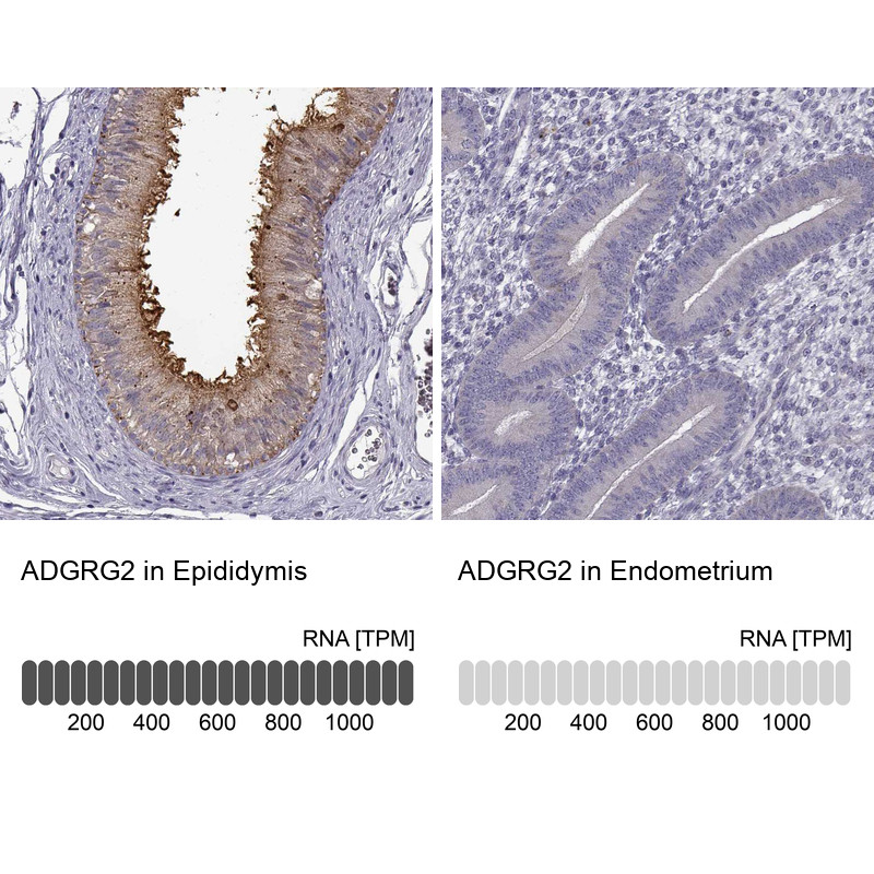 Immunohistochemistry analysis in human epididymis and endometrium tissues using HPA001478 antibody. Corresponding ADGRG2 RNA-seq data are presented for the same tissues.