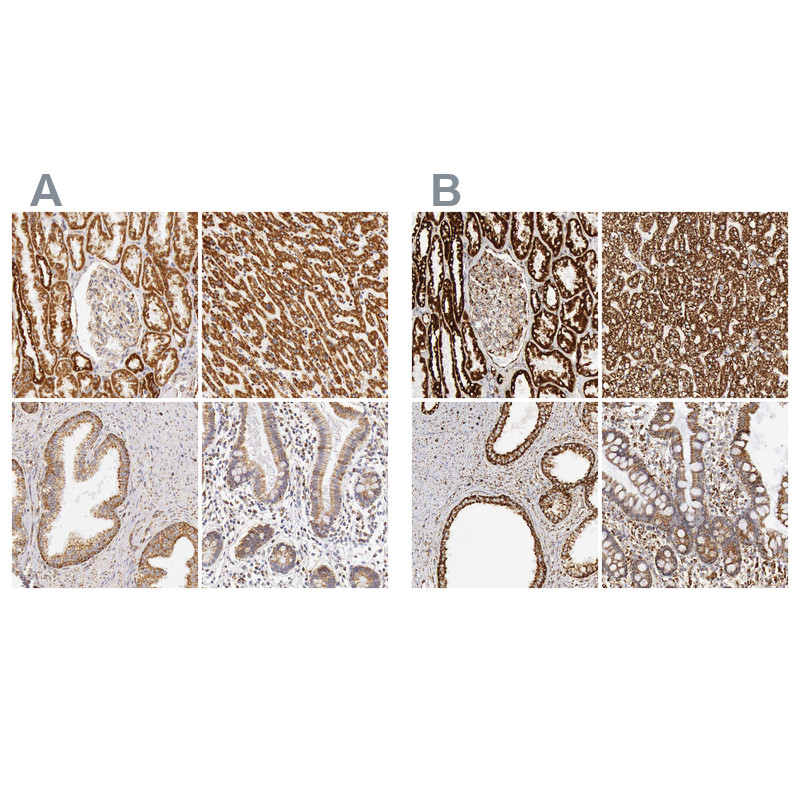 Immunohistochemical staining of human kidney, liver, prostate and small intestine using Anti-ATP5B antibody HPA001520 (A) shows similar protein distribution across tissues to independent antibody HPA001528 (B).