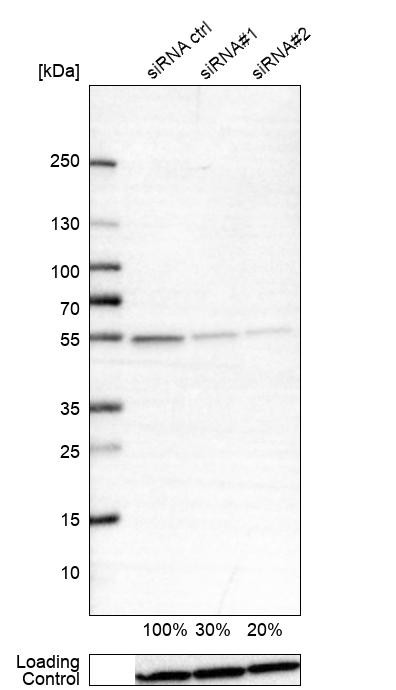 Western blot analysis in A-549 cells transfected with control siRNA, target specific siRNA probe #1 and #2, using Anti-ATP5B antibody. Remaining relative intensity is presented. Loading control: Anti-GAPDH.