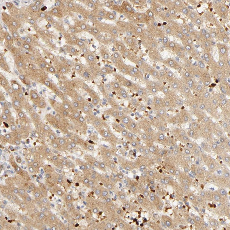 Immunohistochemical staining of human liver shows moderate cytoplasmic positivity in hepatocytes.