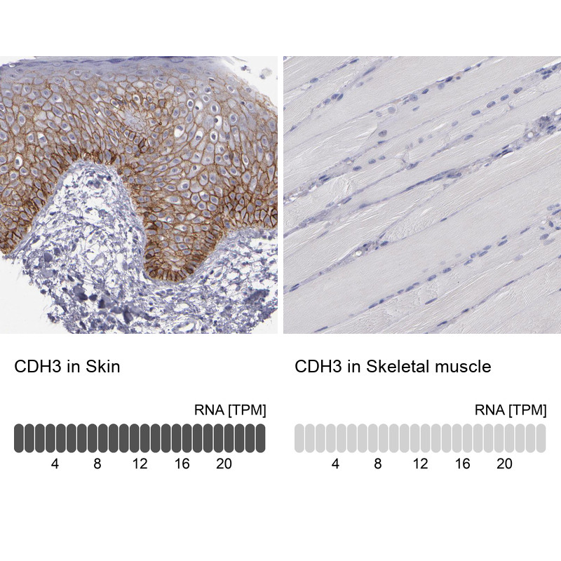 Immunohistochemistry analysis in human skin and skeletal muscle tissues using HPA001767 antibody. Corresponding CDH3 RNA-seq data are presented for the same tissues.