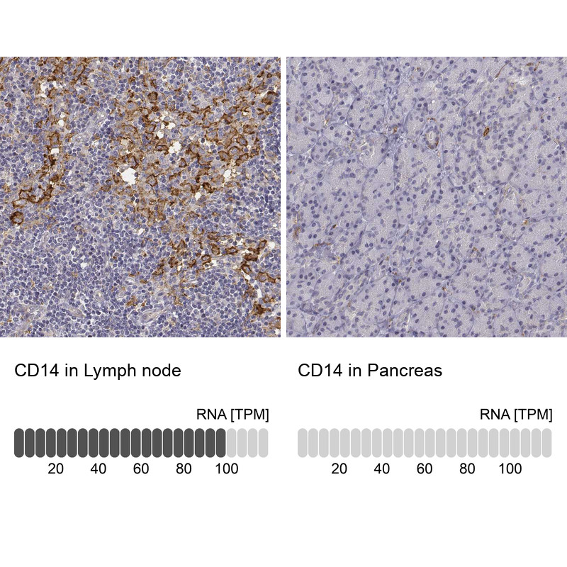 Immunohistochemistry analysis in human lymph node and pancreas tissues using HPA001887 antibody. Corresponding CD14 RNA-seq data are presented for the same tissues.