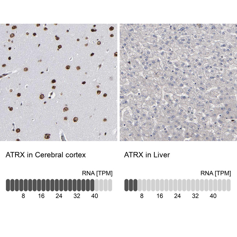 Immunohistochemistry analysis in human cerebral cortex and liver tissues using HPA001906 antibody. Corresponding ATRX RNA-seq data are presented for the same tissues.