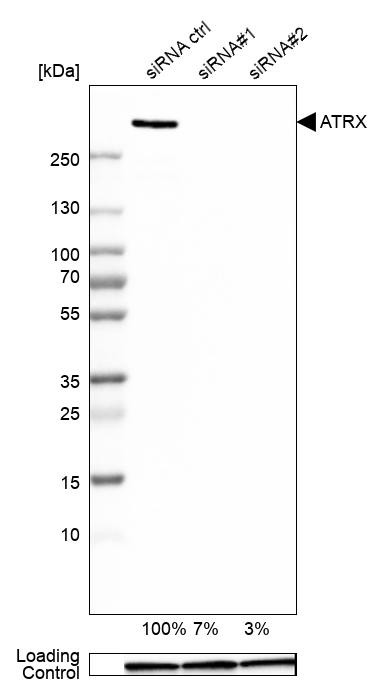 Western blot analysis in A-549 cells transfected with control siRNA, target specific siRNA probe #1 and #2, using Anti-ATRX antibody. Remaining relative intensity is presented. Loading control: Anti-GAPDH.