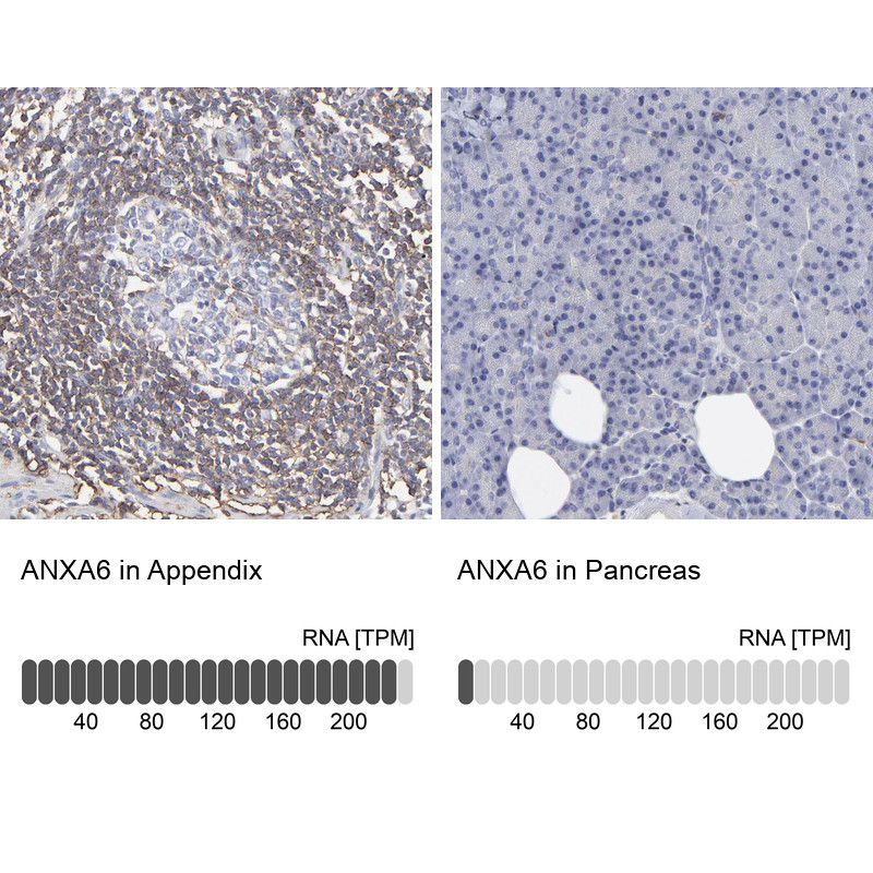 Immunohistochemistry analysis in human appendix and pancreas tissues using Anti-ANXA6 antibody. Corresponding ANXA6 RNA-seq data are presented for the same tissues.