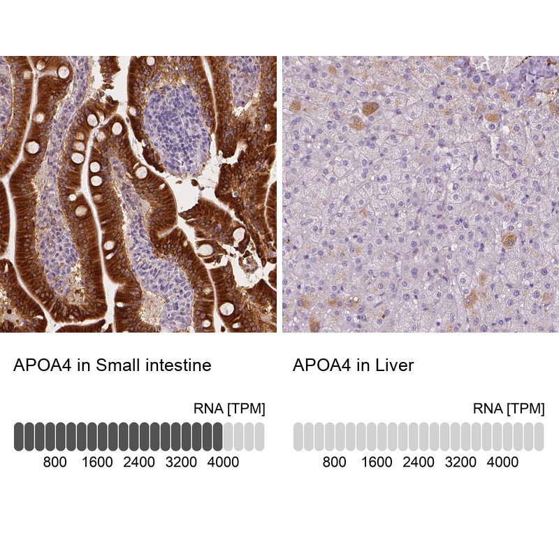 Immunohistochemistry analysis in human small intestine and liver tissues using Anti-APOA4 antibody. Corresponding APOA4 RNA-seq data are presented for the same tissues.