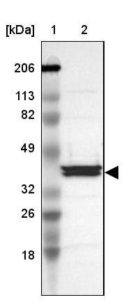 Lane 1: Marker [kDa] 206, 113, 82, 49, 32, 26, 18<br/>Lane 2: Human cell line RT-4