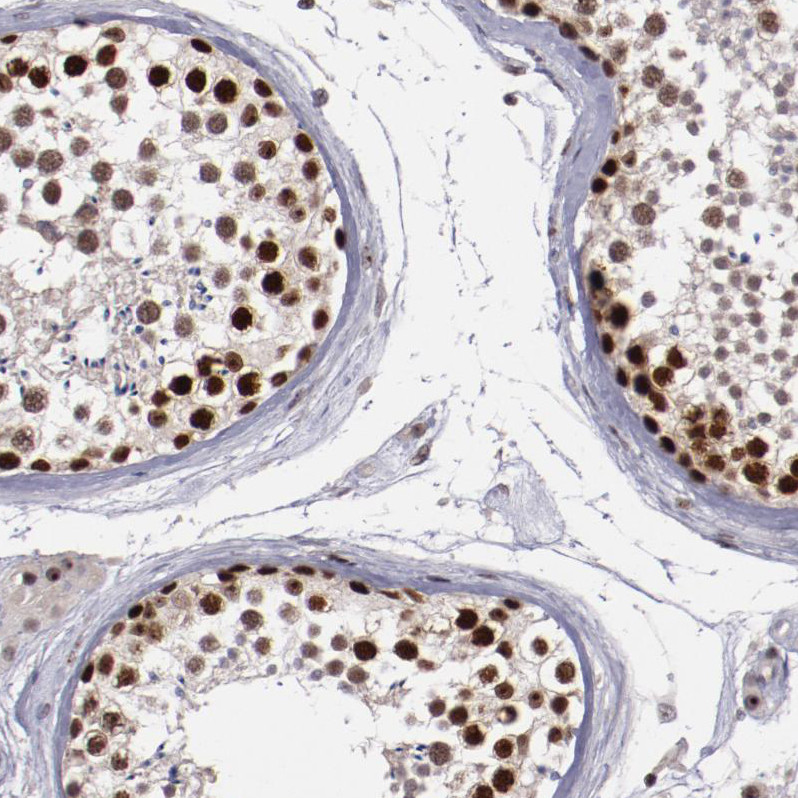 Immunohistochemical staining of human testis shows strong nuclear positivity in cells in seminiferous ducts.