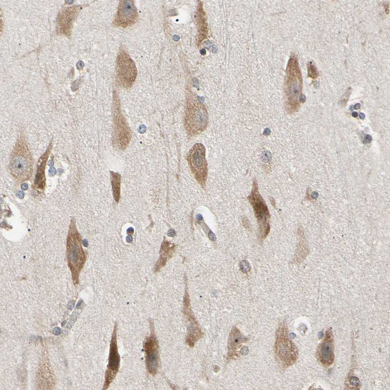 Immunohistochemical staining of human cerebral cortex shows moderate cytoplasmic positivity in neurons.