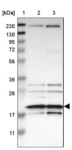 Lane 1: Marker [kDa] 230, 130, 95, 72, 56, 36, 28, 17, 11<br/>Lane 2: Human cell line RT-4<br/>Lane 3: Human cell line U-251MG sp