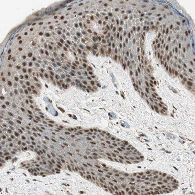 Immunohistochemical staining of human skin shows strong nuclear positivity in squamous epithelial cells.