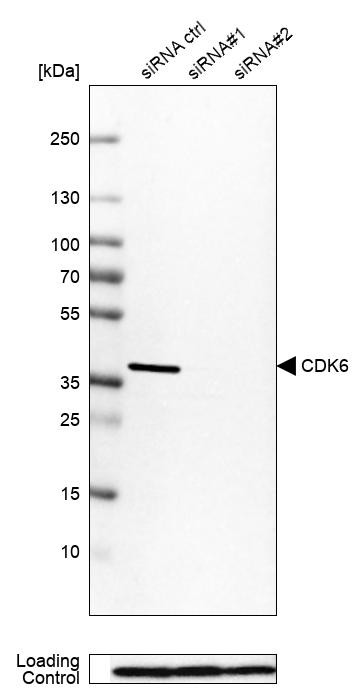 Western blot analysis in Rh30 cells transfected with control siRNA, target specific siRNA probe #1 and #2, using Anti-CDK6 antibody. Remaining relative intensity is presented. Loading control: Anti-PPIB.