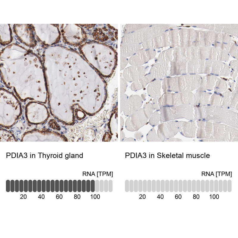 Immunohistochemistry analysis in human thyroid gland and skeletal muscle tissues using HPA002645 antibody. Corresponding PDIA3 RNA-seq data are presented for the same tissues.