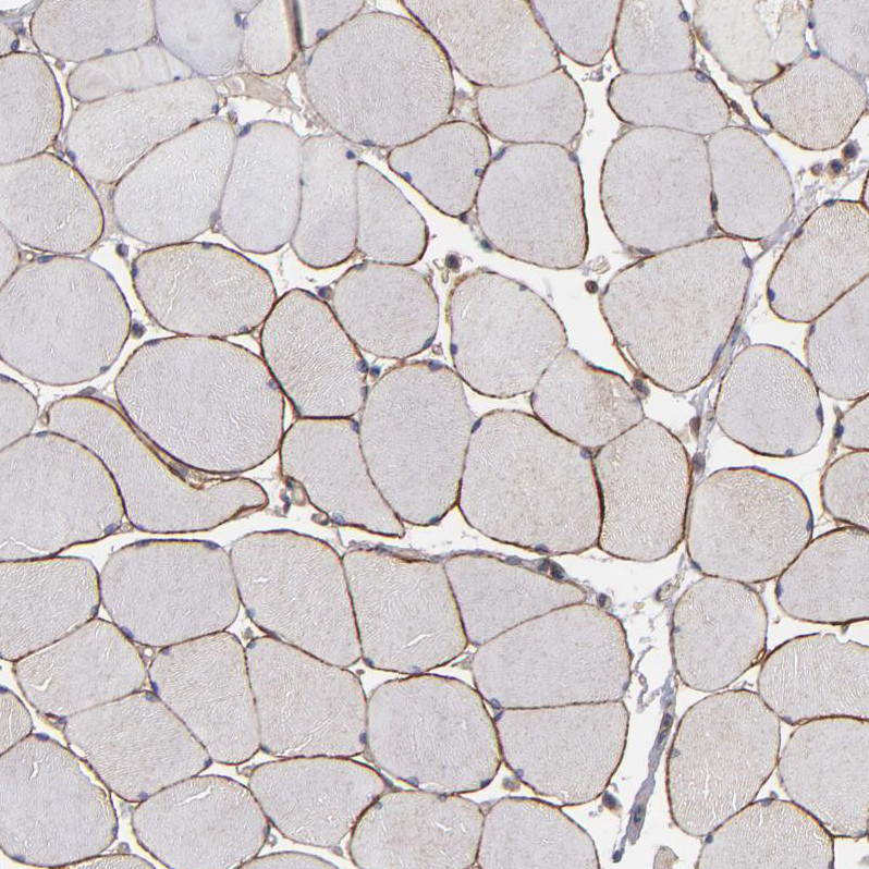 Immunohistochemical staining of human skeletal muscle shows moderate membranous positivity in myocytes.
