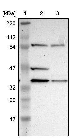 Lane 1: Marker [kDa] 220, 112, 84, 47, 32, 26, 17<br/>Lane 2: Human cell line RT-4<br/>Lane 3: Human cell line U-251MG sp