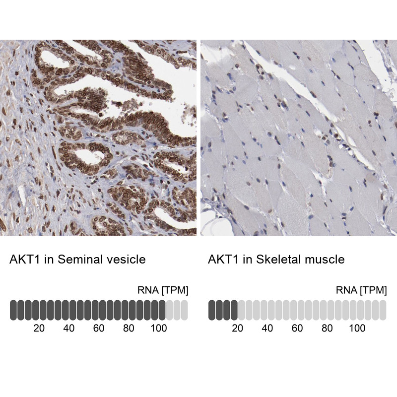 Immunohistochemistry analysis in human seminal vesicle and skeletal muscle tissues using Anti-AKT1 antibody. Corresponding AKT1 RNA-seq data are presented for the same tissues.