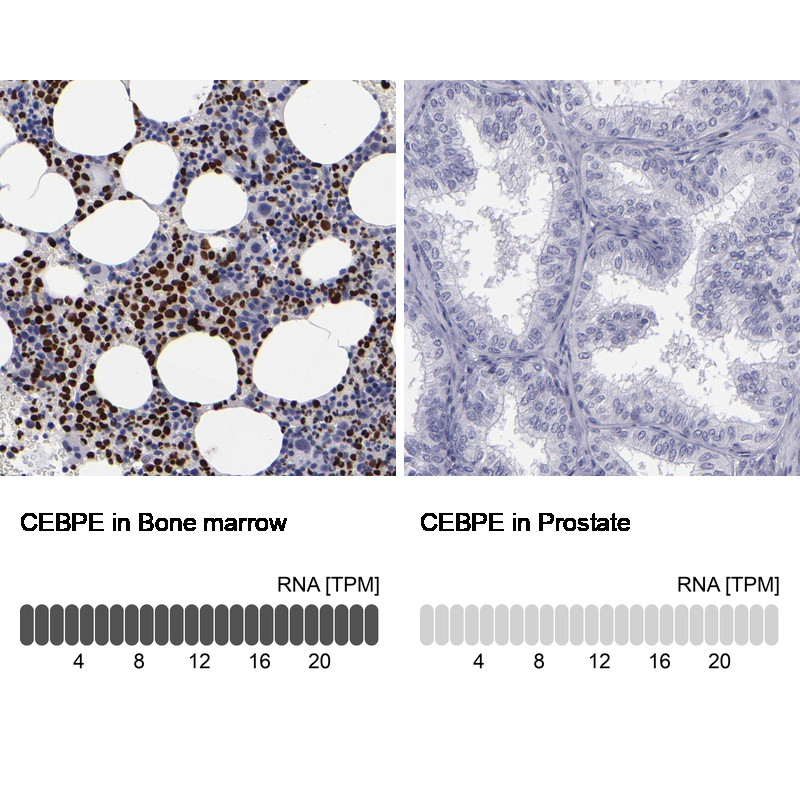 Immunohistochemistry analysis in human bone marrow and cerebral cortex tissues using Anti-CEBPE antibody. Corresponding CEBPE RNA-seq data are presented for the same tissues.