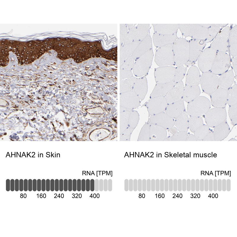 Immunohistochemistry analysis in human skin and skeletal muscle tissues using HPA002940 antibody. Corresponding AHNAK2 RNA-seq data are presented for the same tissues.