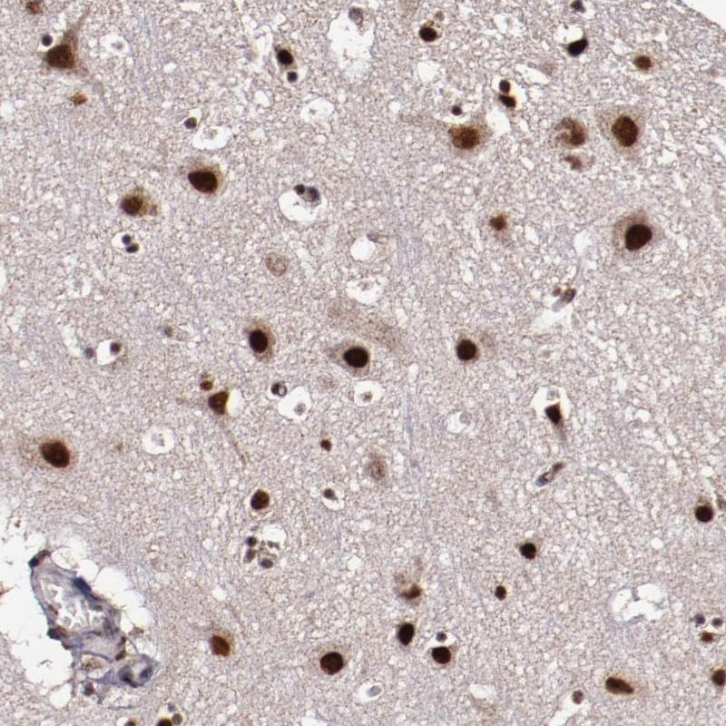 Immunohistochemical staining of human cerebral cortex shows strong nuclear and cytoplasmic positivity in neuronal cells.