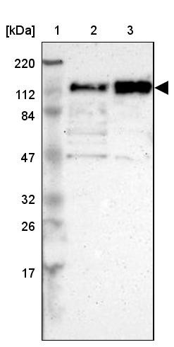 Lane 1: Marker [kDa] 220, 112, 84, 47, 32, 26, 17<br/>Lane 2: Human cell line RT-4<br/>Lane 3: Human cell line U-251MG sp