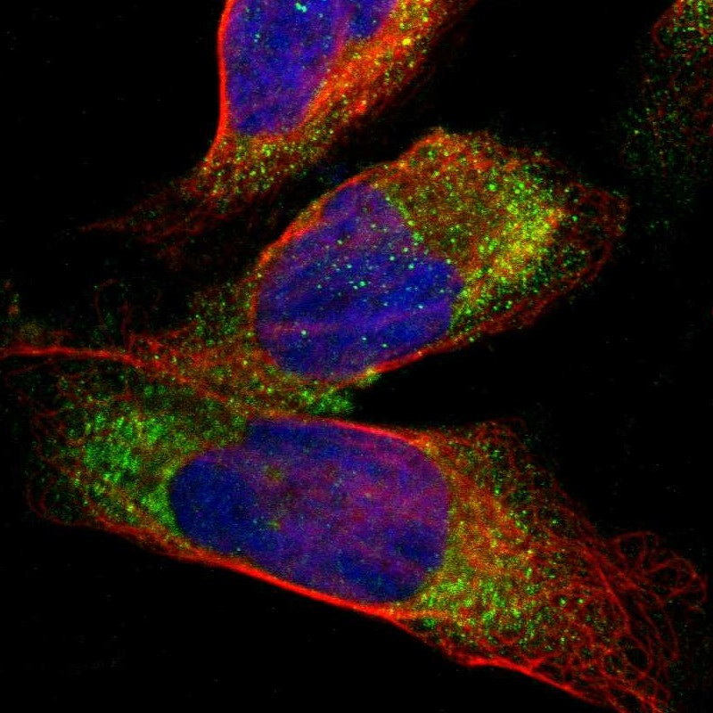 Immunofluorescent staining of human cell line U-2 OS shows localization to vesicles.
