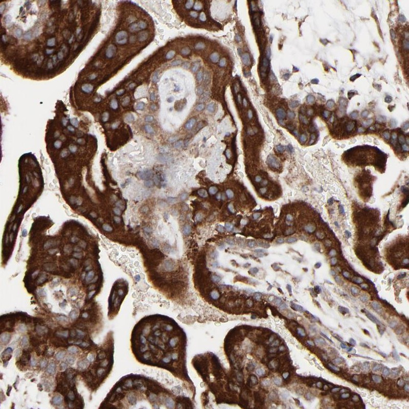 Immunohistochemical staining of human placenta shows strong cytoplasmic positivity in trophoblastic cells.