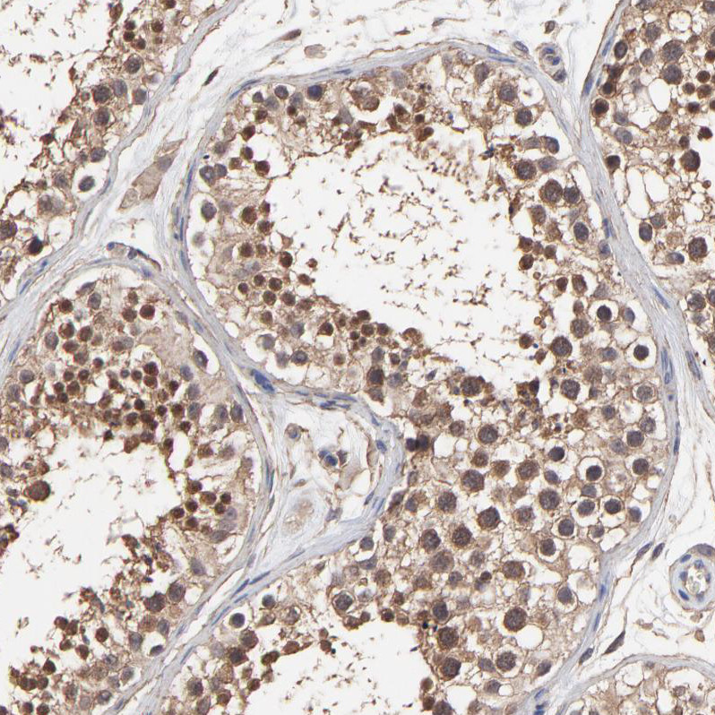 Immunohistochemical staining of human testis shows moderate nuclear and cytoplasmic positivity in cells in seminiferous ducts.