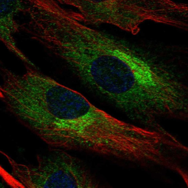 Immunofluorescent staining of human cell line BJ shows localization to endoplasmic reticulum & the Golgi apparatus.