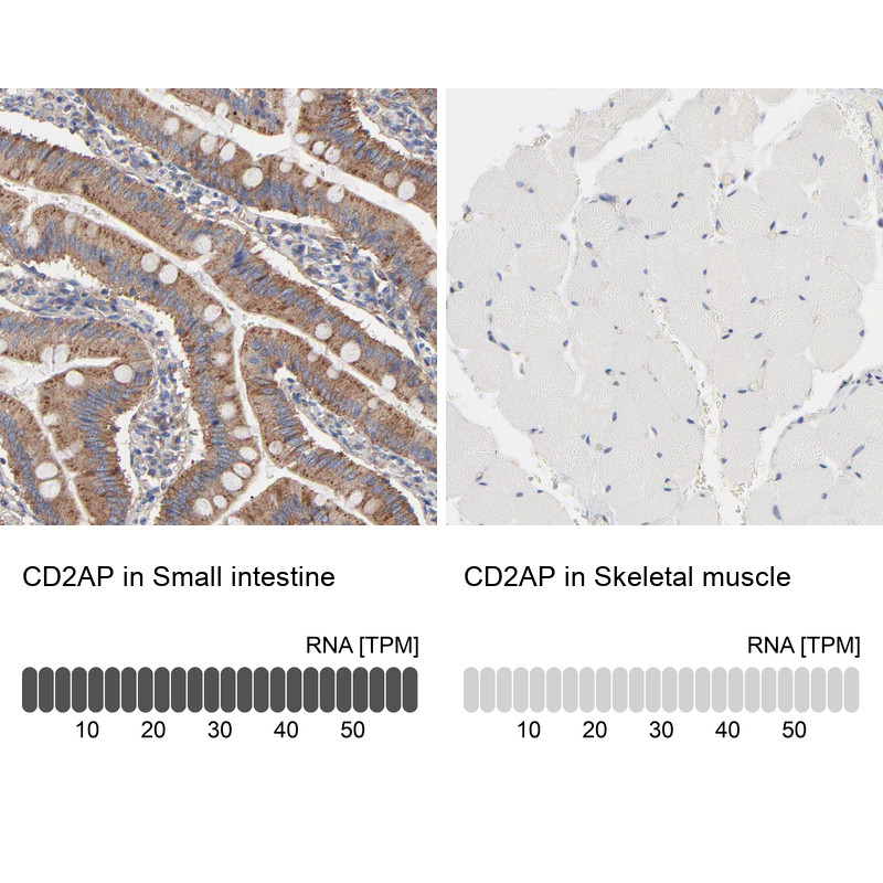 Immunohistochemistry analysis in human small intestine and skeletal muscle tissues using HPA003267 antibody. Corresponding CD2AP RNA-seq data are presented for the same tissues.
