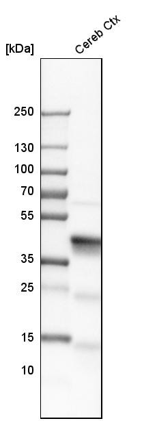 Western blot analysis in human cerebral cortex tissue.