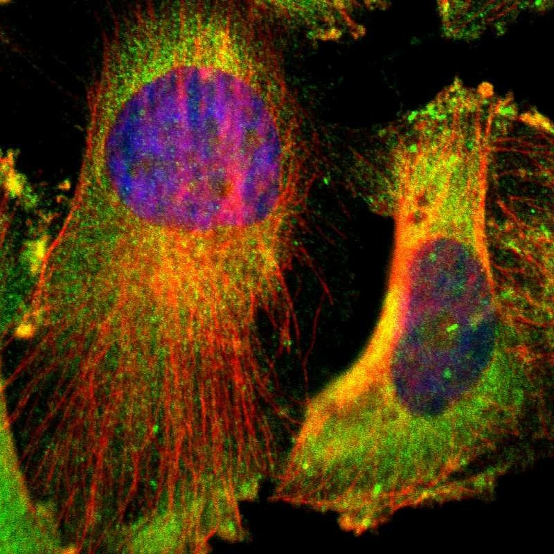 Immunofluorescent staining of human cell line U-251 MG shows localization to plasma membrane & cytosol.