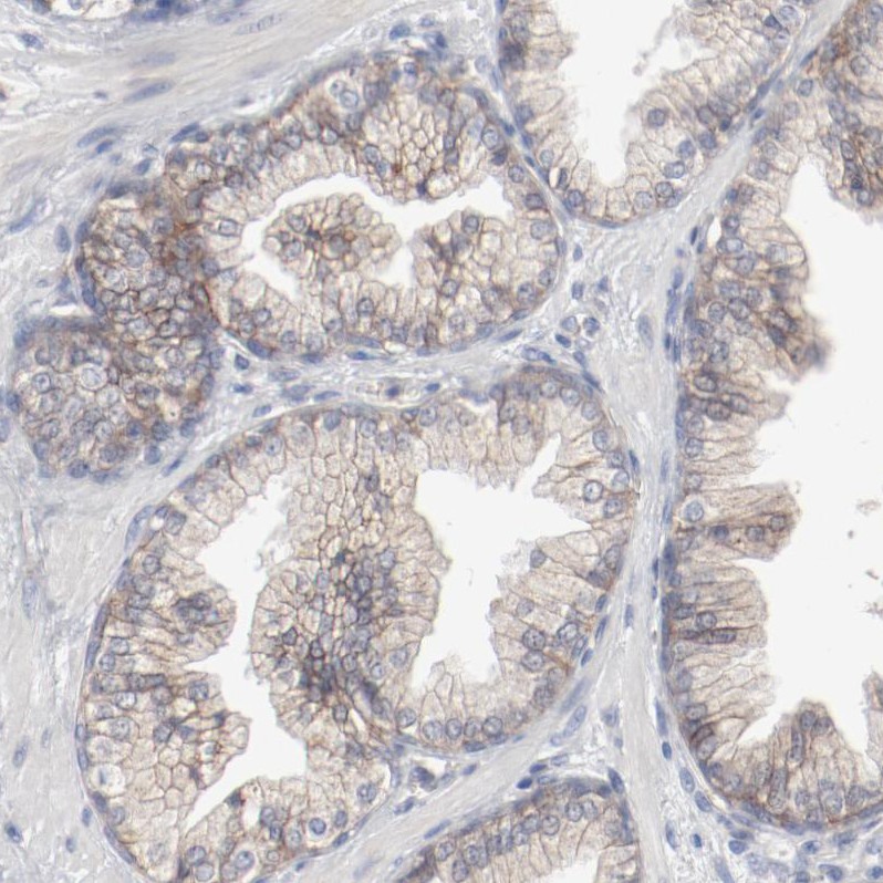 Immunohistochemical staining of human Prostate shows moderate membranous positivity in glandular cells.
