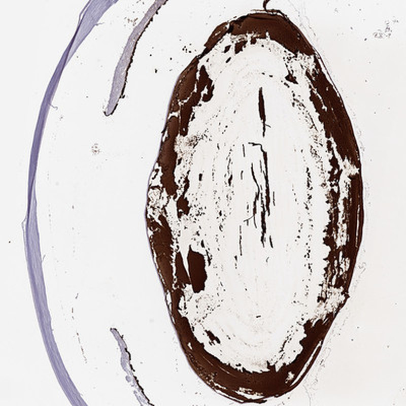 Immunohistochemical staining of human eye shows strong positivity in lens.